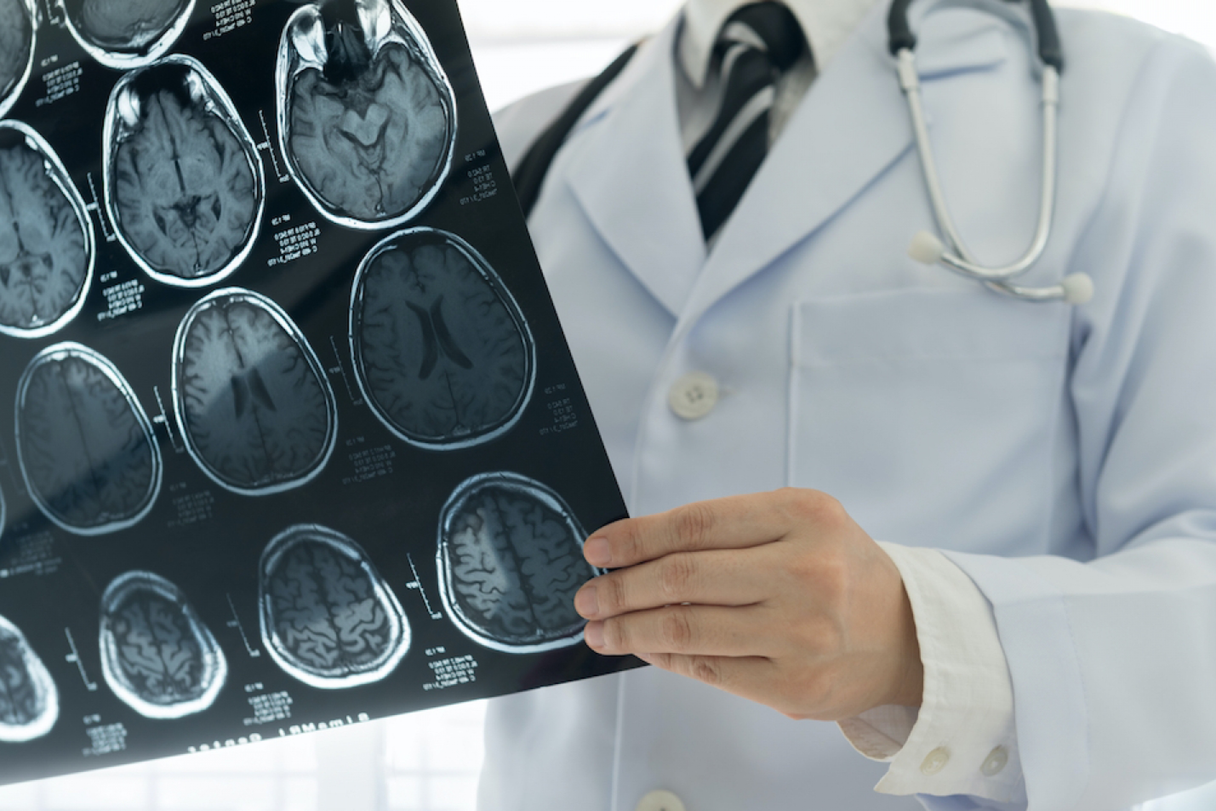 Arizona Blood and Cancer Specialists